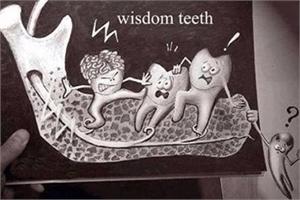 Wisdom tooth joke