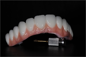 What types of denture damage can a denture specialist repair