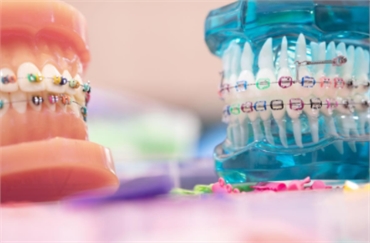 A Guide to Different services offered by an Orthodontist