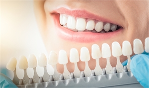 New Solutions for you from your Cosmetic Dentist in Miami