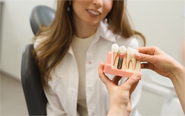 Ensuring Your Smile Shines Bright with Dental Implants in Miami FL