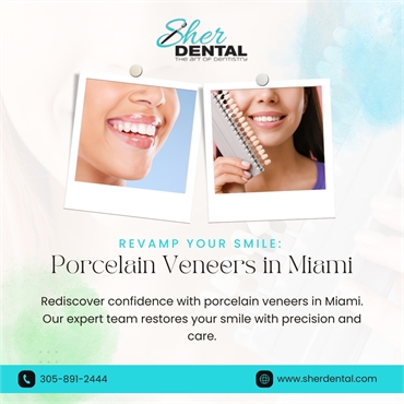 6 Things to Look For When Considering Dental Veneers in Miami