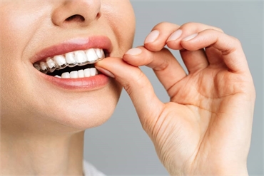 Straighten Your Smile in Six Months by Transformative Braces Solutions at Miami Modern Dental