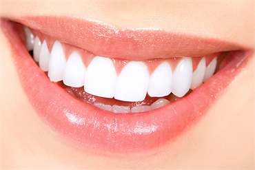 All You Need To Know Before You Pursue Teeth Whitening Treatment In Miami