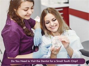 Do You Need to Visit the Dentist for a Small Tooth Chip