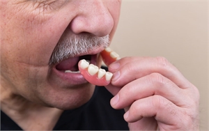 Are Digital Dentures the Right Solution for You