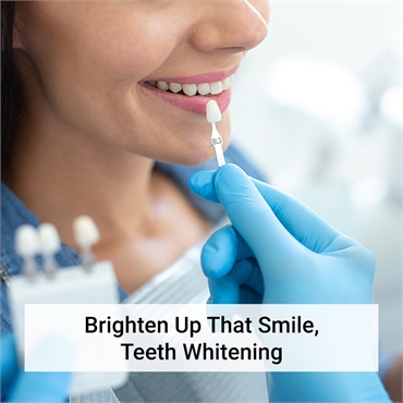Teeth Whitening 89129