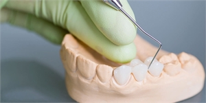 Restorative Dentistry Dental Bridges Treatment