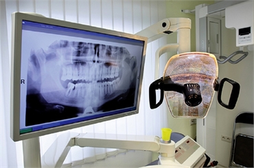 Digital dental x ray machine at Bonita Dental Care
