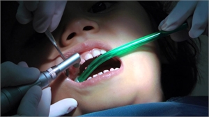 Restorative Dentistry Treatment Choices for Children