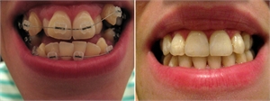 Alternatives in orthodontics