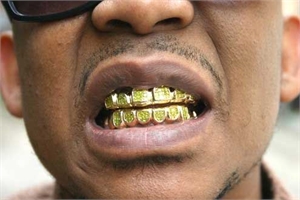 What are teeth grillz and bling bling removable teeth?