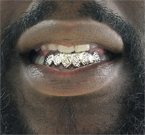 Teeth grills on front teeth
