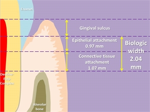 What is biological width in dentistry?
