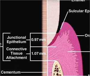 Biological width in dentistry is the total width covered by the junctional epithelium and the connective tissue attachment