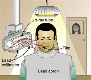 The x-ray tube is pointed to the x-ray sensor. The lead collimator concentrates the x-ray beam to the examined area in the mouth. The person taking the x-ray is out of the room for radiation protection.
