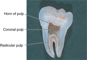 Dental pulp horns