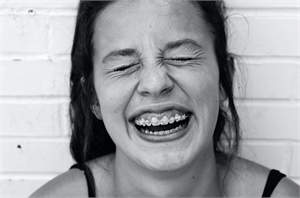 Girl smiling wide with braces on