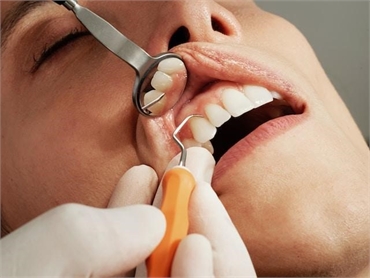 5 Ways to Manage Pain After Oral Surgery
