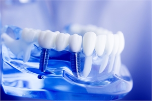 Are most people happy with dental implants