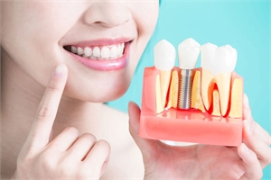 How does a dental bridge function to replace missing teeth