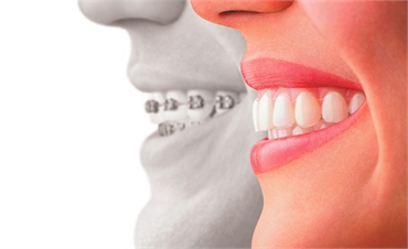 Top 5 Current Trends to Watch in the Field of Cosmetic Dentistry