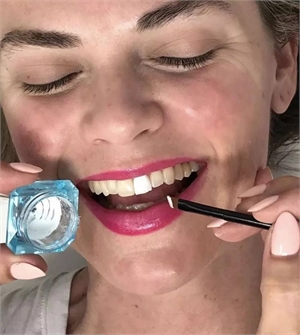 Painting teeth with a dental makeup to change its color