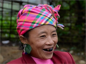 Teeth blackening was performed by females when they come to an age for marriage