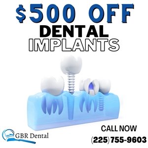 Implant Special