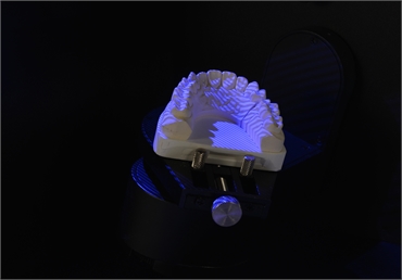 stone model scanning by UP3D dental 3d model scanner