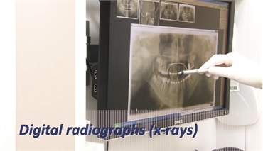 digital dental x-rays