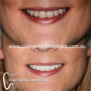 Canberra Dental Orthodontics