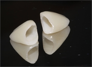 What is a porcelain fused to zirconia (PFZ) dental crown?