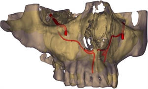 Canalis Sinuosus – anatomy and variation