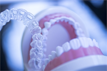 Are Clear Aligners Effective
