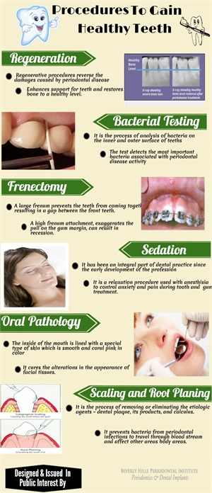 Procedures to gain healthy teeths