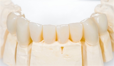 Different Types Of Dentures and What is Best For You
