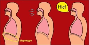 Diaphragm spams are the cause for hiccups
