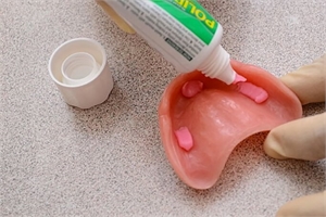 Adhesive paste which you put on the dentures to keep it stable