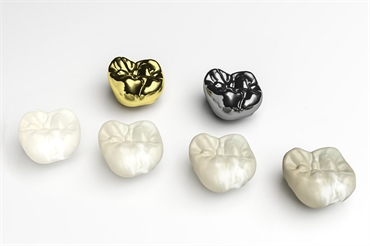 Dental Crowns  What it is Types and Procedure