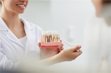 Why Dental Implants are the Best Solution for Missing Teeth