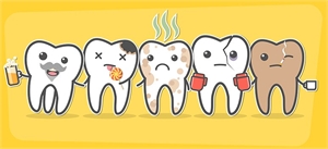 What causes teeth staining?
Main causes of teeth staining are: coffee, red wine, smoking, leakage, old composite or amalgam fillings, age, fluorosis, dental trauma, tartar buildups, tooth decay.