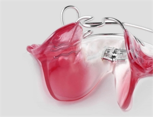 Bionator removable appliance corrects jaws discrepancy