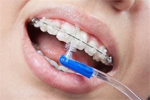Toothbrush for orthodontic braces
