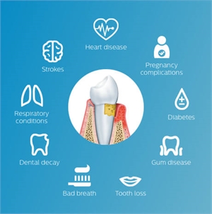 Dental Health Is A Necessity For Ideal Health