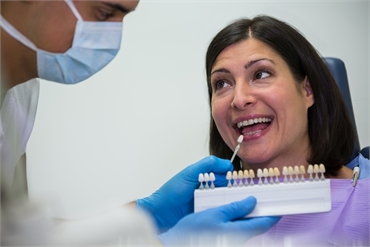 How to Achieve a Perfect Smile with Dental Veneers