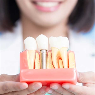 Same-Day Dental Implants