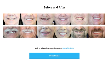 Before and After for Dental Implant