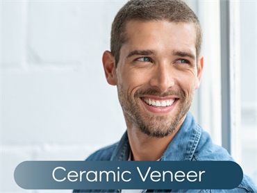 Ceramic Veneer