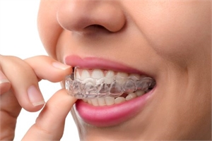 Removable teeth retainer after orthodontic treatment
